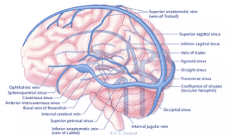 Brain thrombosis